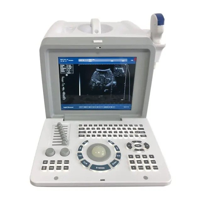 imgi 2 AK S2181