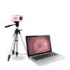 imgi 6 Medical Digital Video Colposcope Gyneco